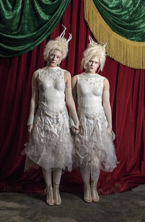 Featured image of post Albino Twins Greatest Showman